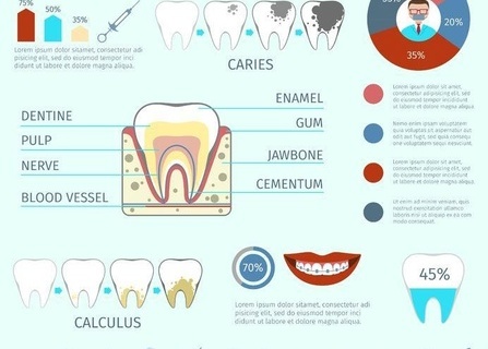 高性价比导致九成用户选择年抛隐形眼镜