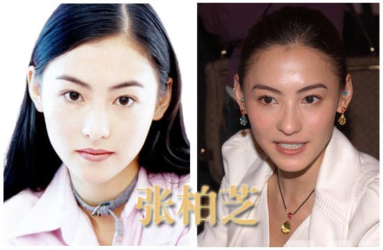 明星瘦臉前后差別有多大(圖)