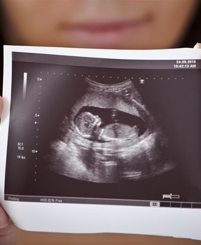 教你省钱又漂亮画指甲 教你省钱又漂亮画指甲