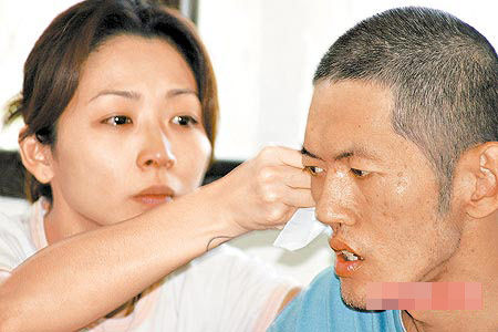 林晓培哥哥精神分裂 疗养院中度过12年 林晓培哥哥精神分裂 疗养院中度过12年