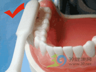 口腔健康 刷牙不是全部 还必须洗牙