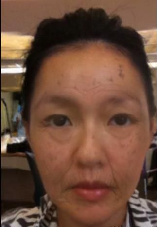 惊曝：小S容颜衰老照