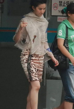刘亦菲活动后不慎摔跤看急诊