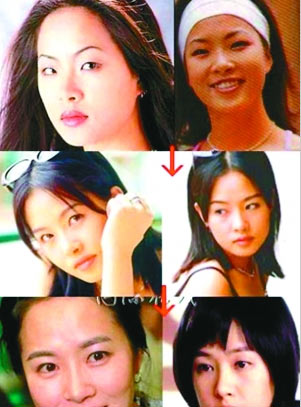 19位韩国女星整形前后大曝光