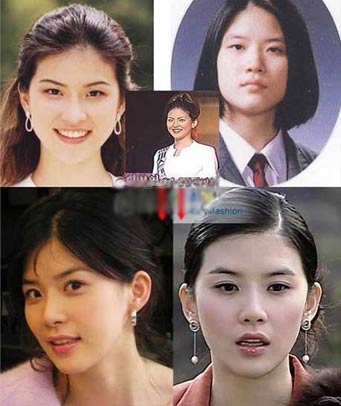 19位韩国女星整形前后大曝光