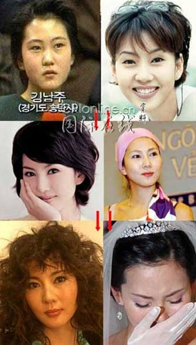 19位韩国女星整形前后大曝光