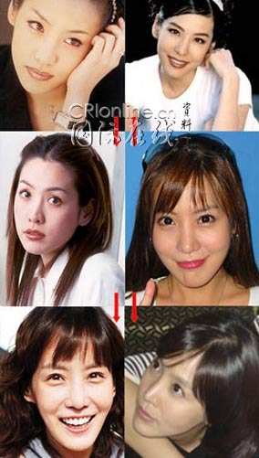 19位韩国女星整形前后大曝光