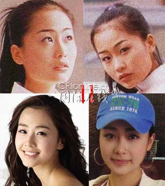 19位韩国女星整形前后大曝光