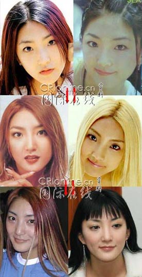 19位韩国女星整形前后大曝光