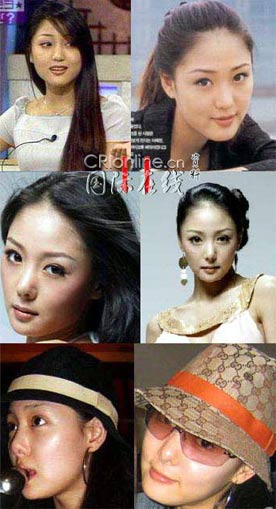 19位韩国女星整形前后大曝光