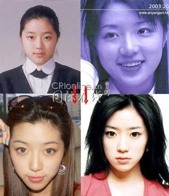 19位韩国女星整形前后大曝光