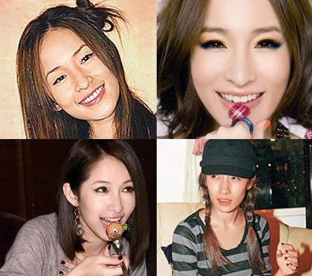 医生爆料:这些明星都整过形了