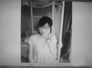 17岁少女接受药物治疗后长胡子(组图) 17岁少女接受药物治疗后长胡子(组图)