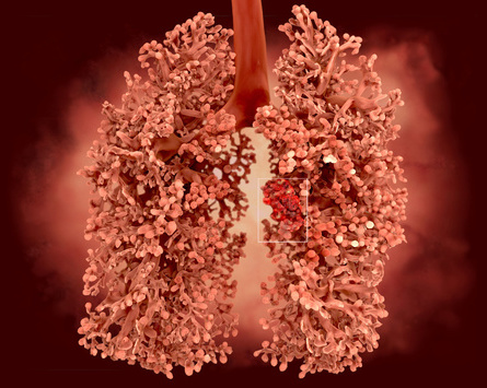 媒体曝光味精掺假 用非食用硫酸镁降成本(图) 媒体曝光味精掺假 用非食用硫酸镁降成本(图)