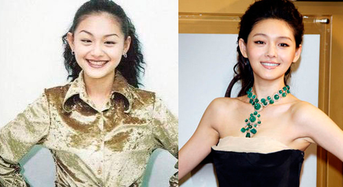 明星变脸是整容还是女大十八变？_整形