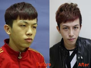 台湾17岁男孩整形变美少男 整形该不该“从娃娃抓起”_整形
