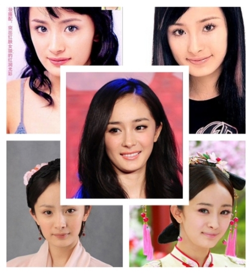 2011年最红人杨幂——整容风波不断_整形