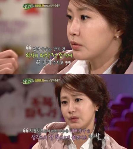 韩星申恩庆曝惨痛整容经历 告诫观众谨慎整容_整形