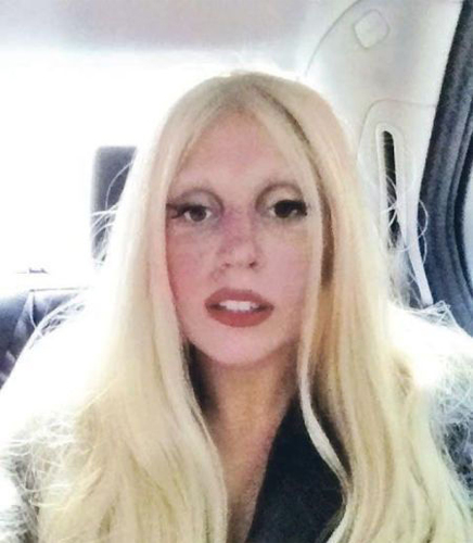 LadyGaga演唱会红血丝毁脸 急救有妙招 LadyGaga演唱会红血丝毁脸 急救有妙招