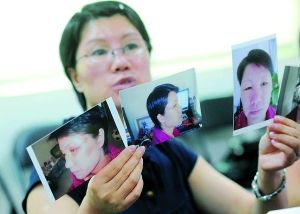 花万元整容被注一元奥美定 几近毁容_整形