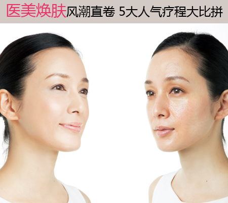 医美焕肤风潮直卷 5大人气疗程大比拼_整形
