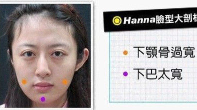 美丽日记：下颌角整形打造精美瓜子脸_整形