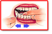 专家：如何正确使用牙线预防牙周疾病？
