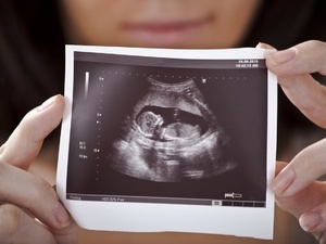 四维彩超直击：子宫里的多胞胎（组图）