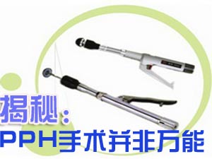 南方医院肛肠科李胜龙：PPH手术并非万能