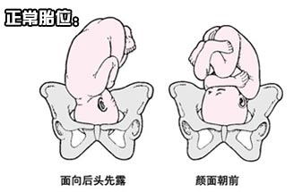 孕八月注意宝宝的胎位