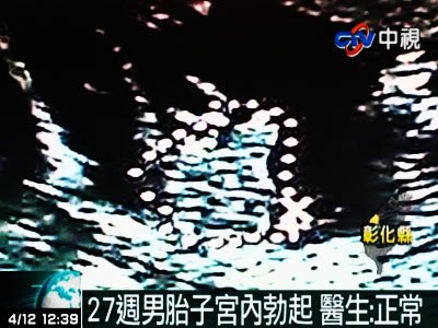 ̨һи췢澰 27̥ӹο(ͼ)
