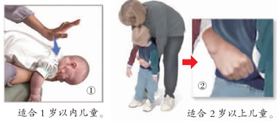 孩子吞下异物怎么办？