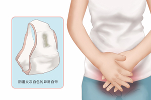 女性阴炎有什么症状