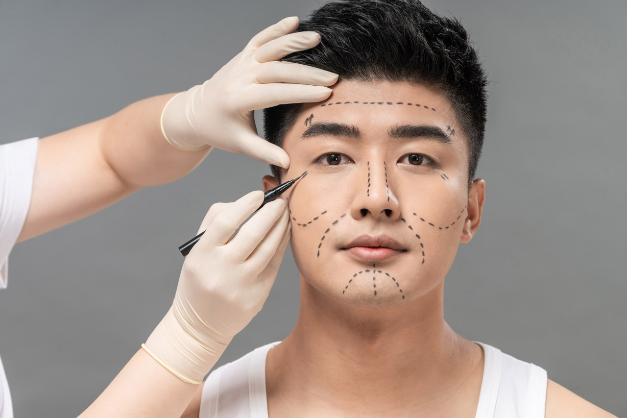 上海面部整形去哪里治比较专业