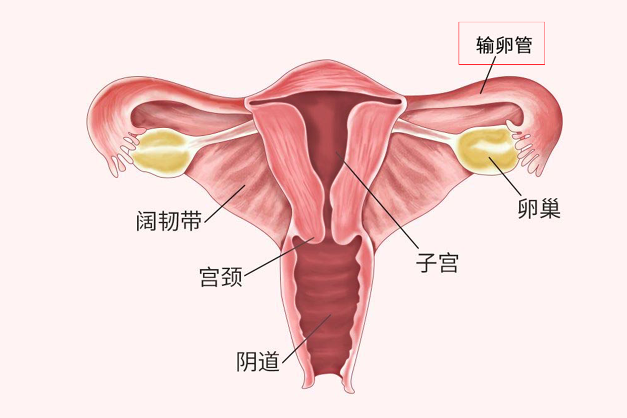 试管婴儿移植前要不要处理输卵管积水问题