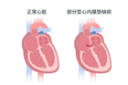 胎儿心内膜垫缺损最大的原因有哪些