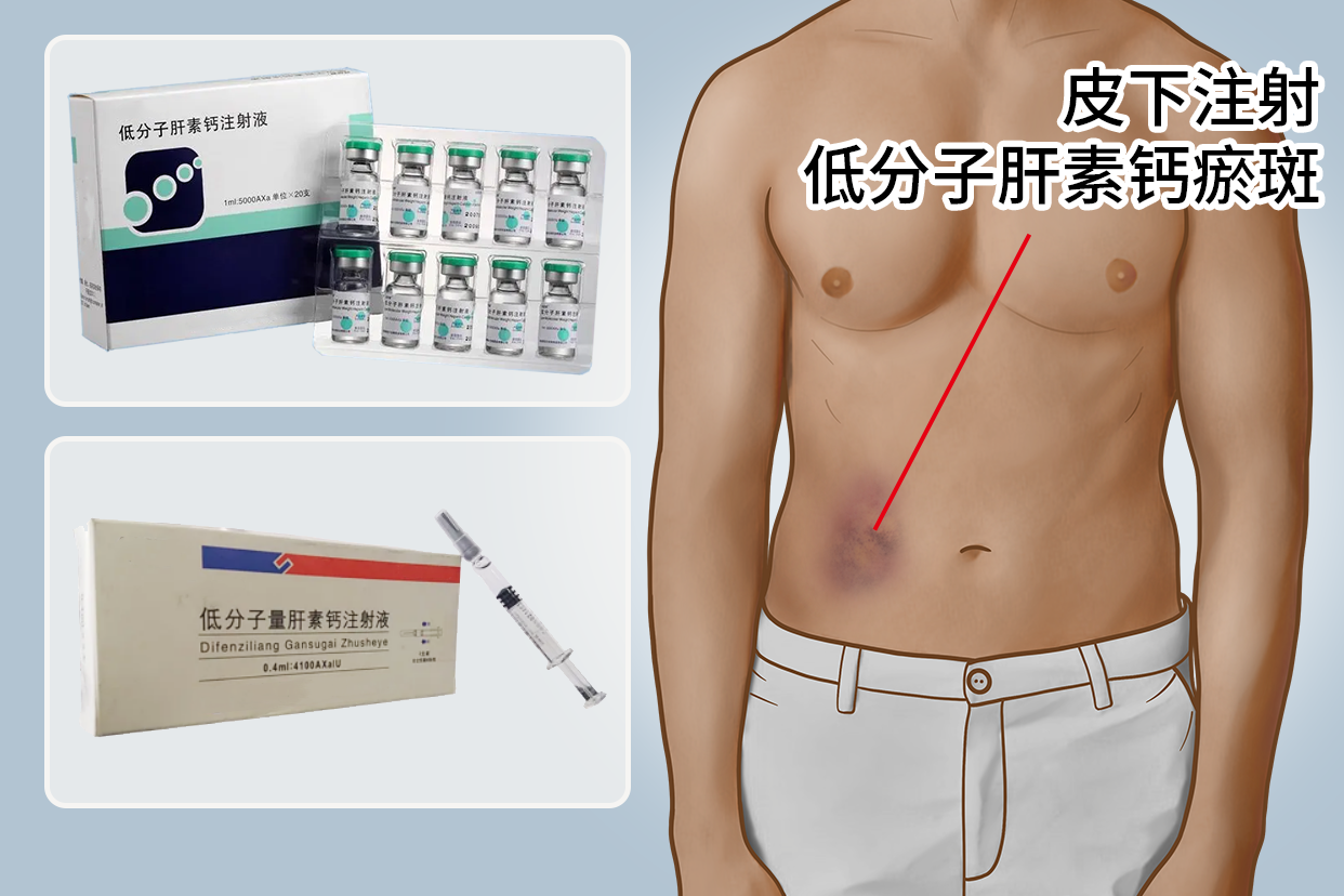 超全超实用!25条肝素小常识,建议收藏!
