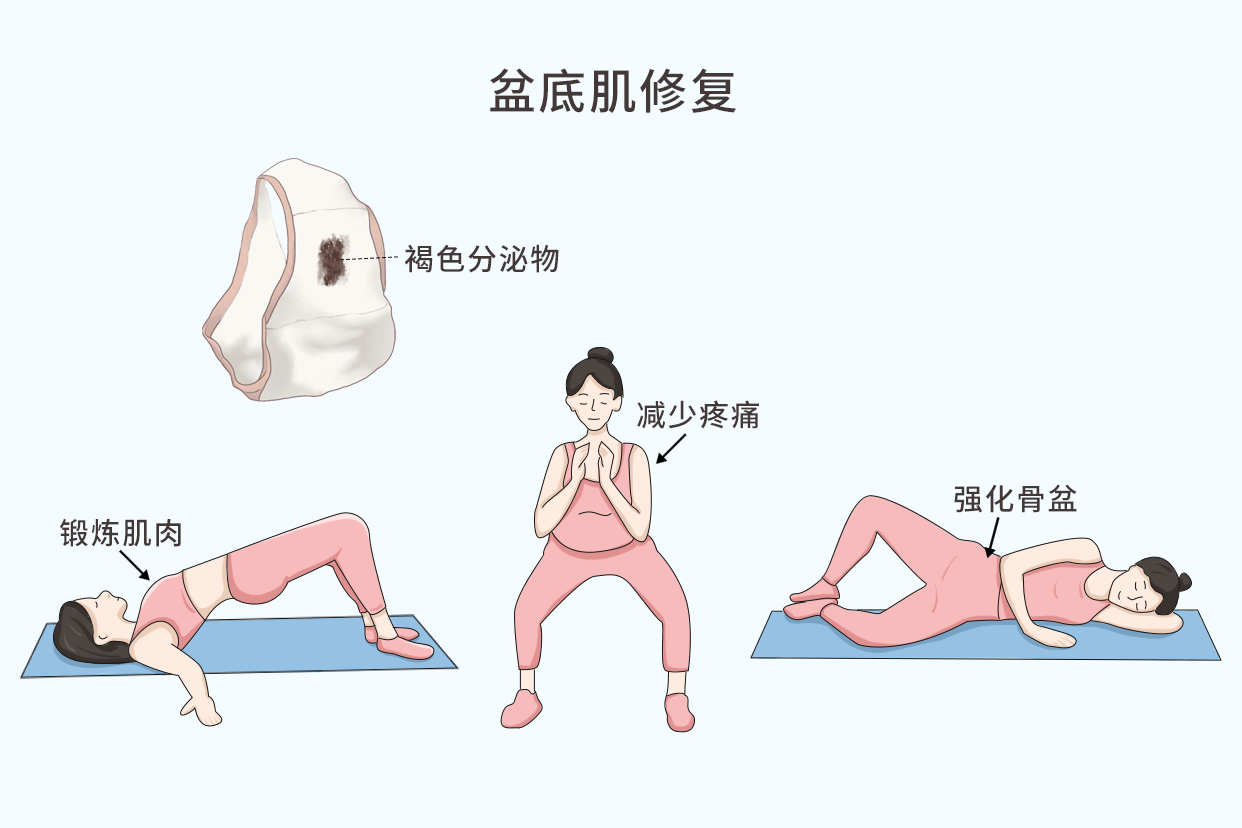 产后做盆底恢复有用吗