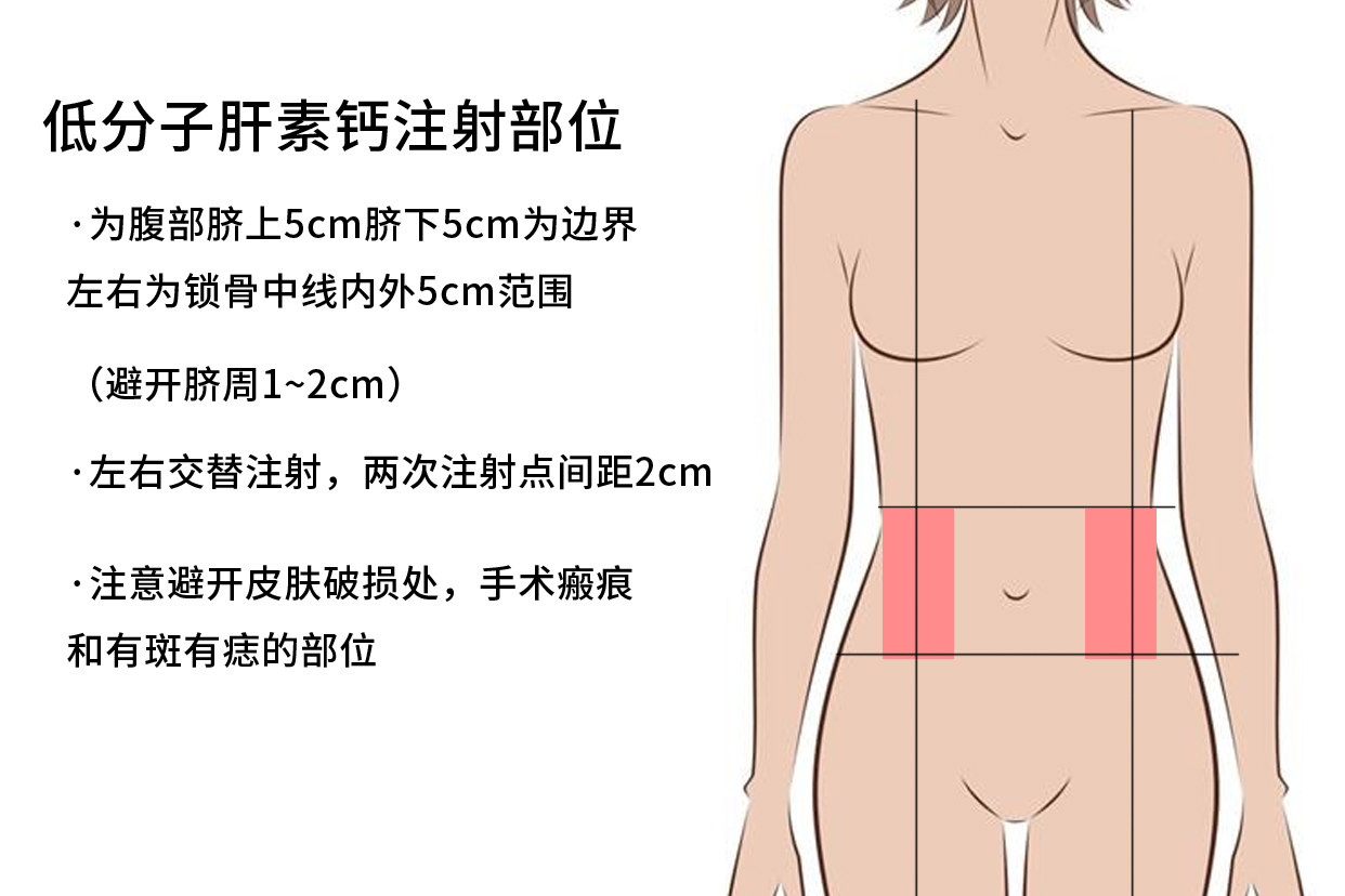 肝素,又爱又恨的宝贝,优缺点分享