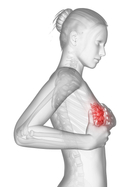 原发性乳腺淋巴瘤严重吗