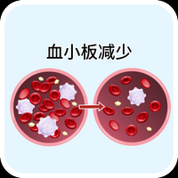 ITP是什么意思
