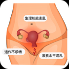 功能性子宫出血是什么原因，吃什么药