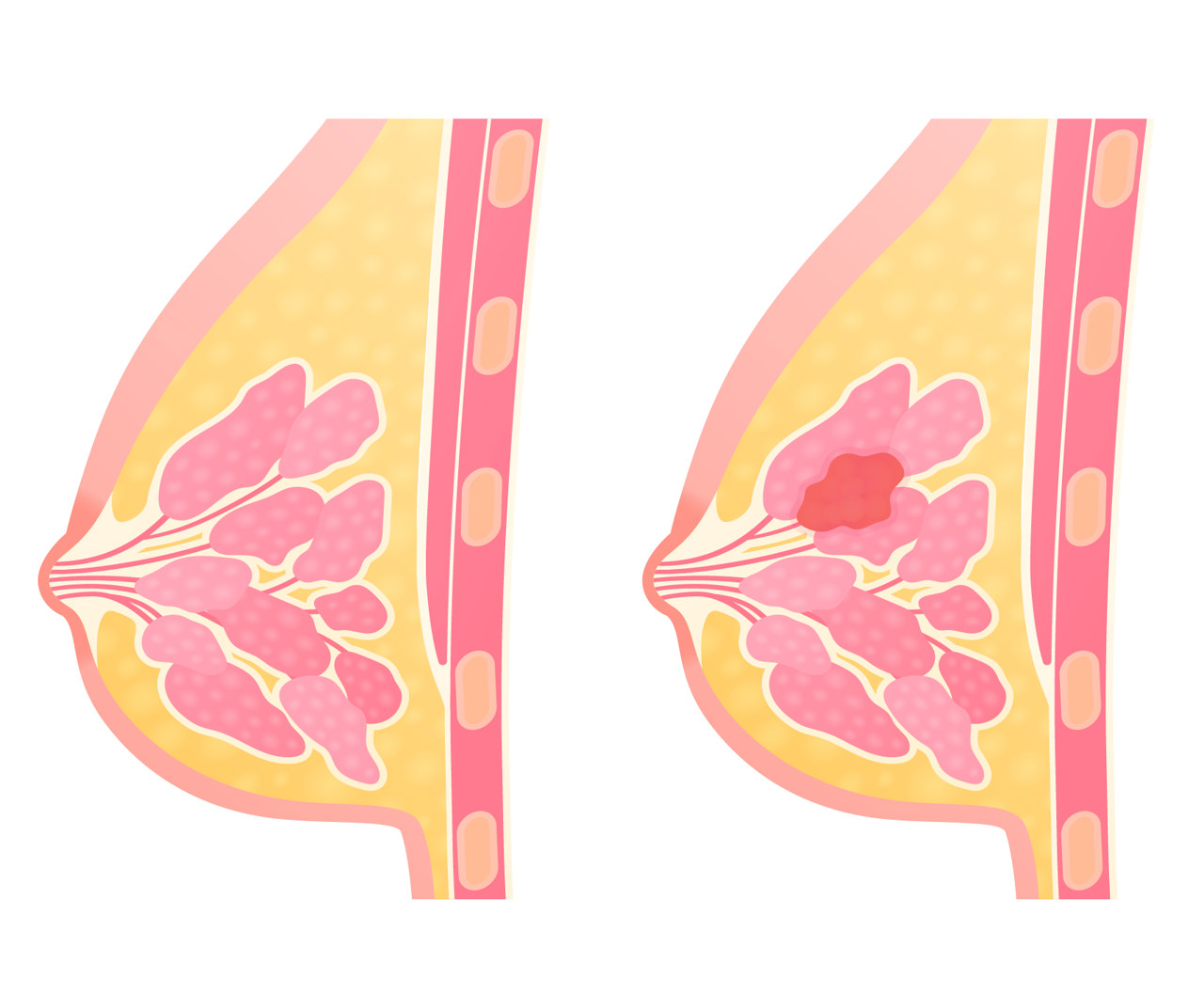 苏州乳腺结节医院五佳排行更新？