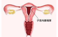 胆囊息肉有效的治疗方法