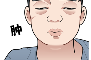 腮腺炎会引起整个面部肿胀吗