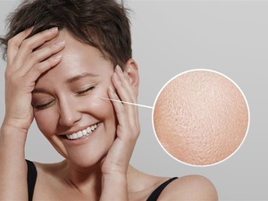 如何区分是否有白癜风