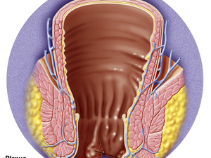 局部性腹膜炎怎么治疗