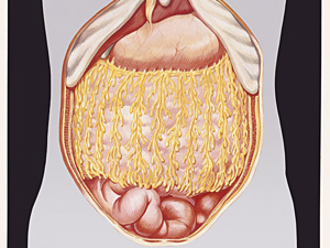 腰腹吸脂第二天小腹