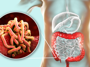 感染性腹泻的常见类型是