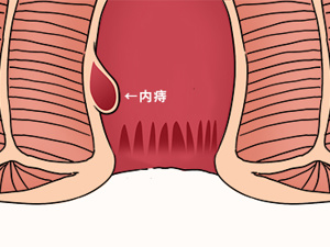 患者_舒痔丸